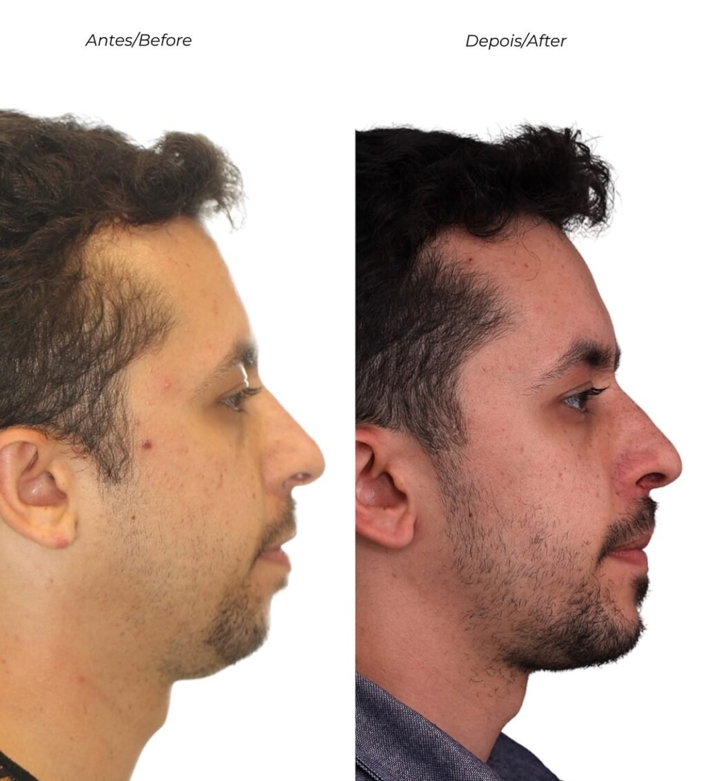 Instagram post from drviniciusdantas. This post is in position 3.