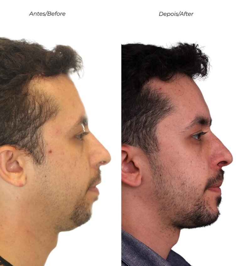 Instagram post from drviniciusdantas. This post is in position 4.